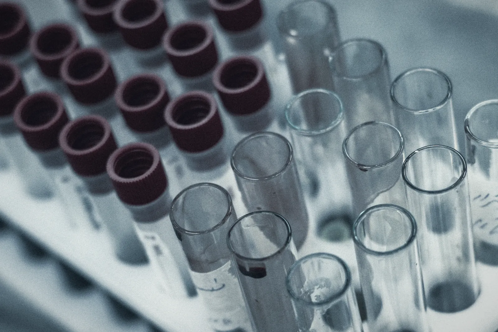 Tubos de coleta de sangue com tampas vermelhas em uma estante de laboratório